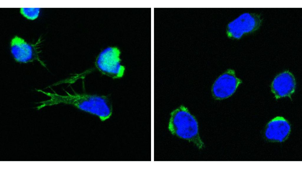 Healthy T cells (left) and DOCK11-deficient T cells (right) with visible nucleus (blue) and aktin-cytoskeleton (green). ©St. Anna CCRI